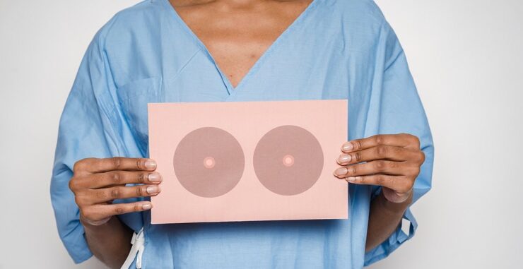 Black woman holding a sketch of breasts to signify breast cancer